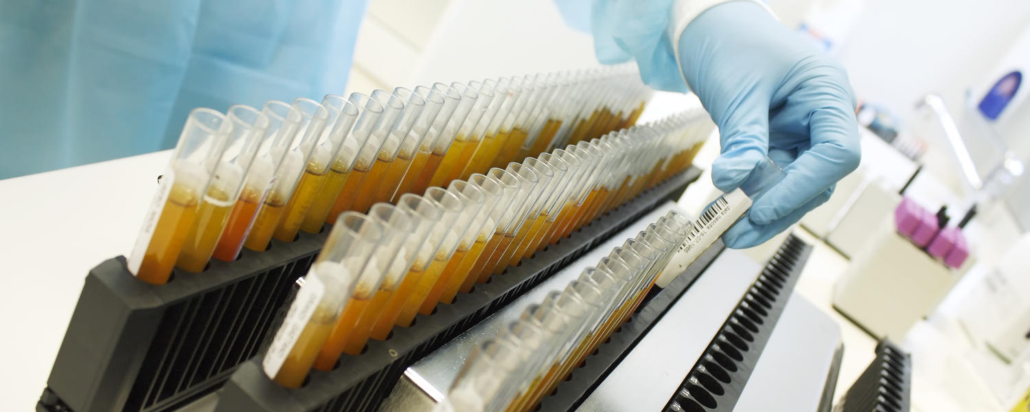 Clark H. Smith Tissue Bank