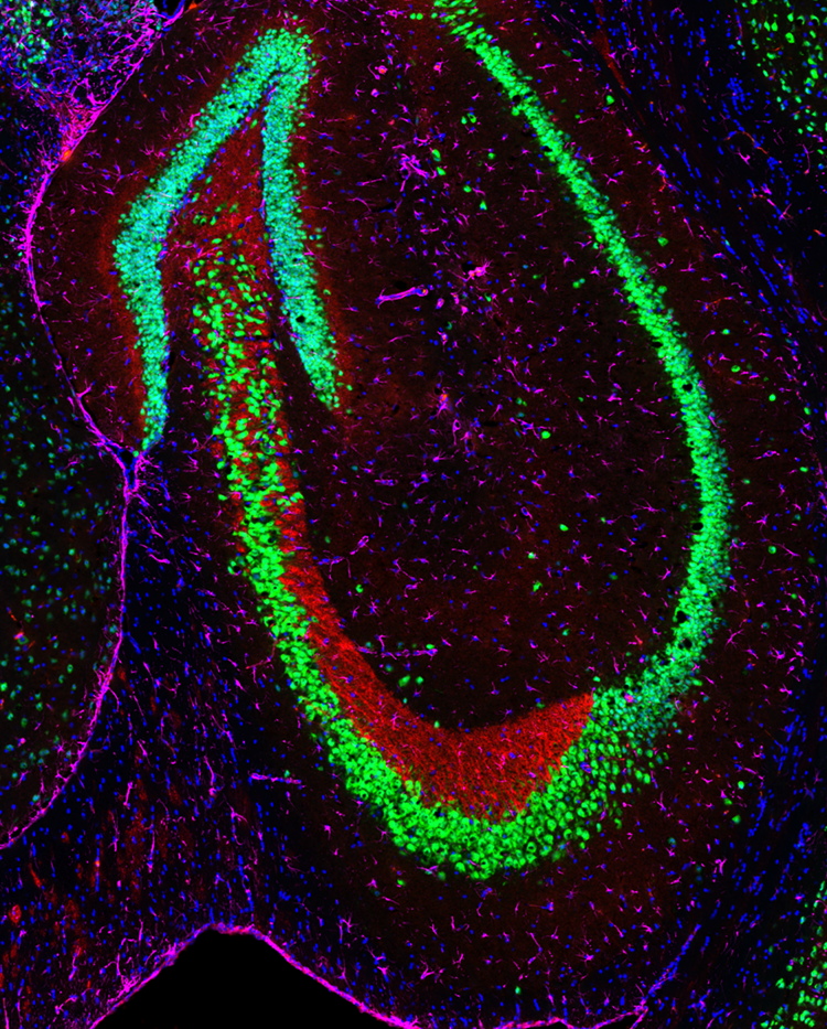 HBI-AMP Mohamed Hassan, Lytton lab Mouse brain hippocampus HBI-AMP Mohamed Hassan, Lytton lab Mouse brain hippocampus