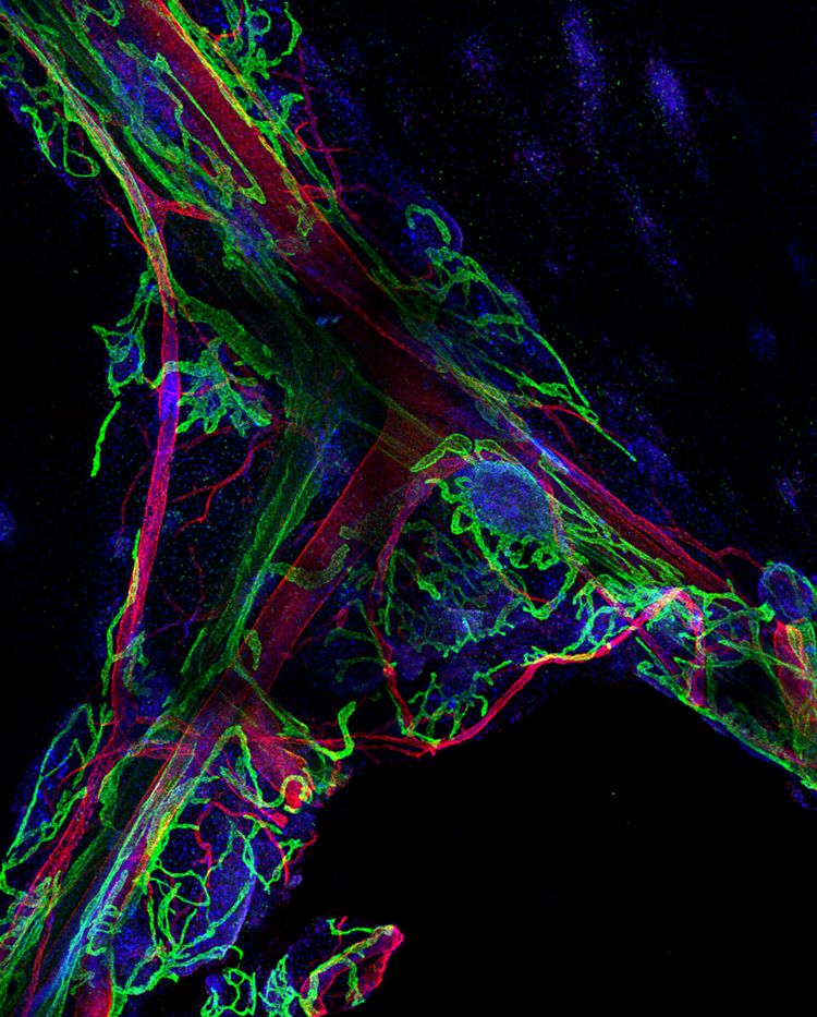 Open Keith Keane, von der Weid lab Lymphatic vessel network Open Keith Keane, von der Weid lab Lymphatic vessel network